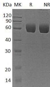 Human AGT/SERPINA8 (His tag) recombinant protein