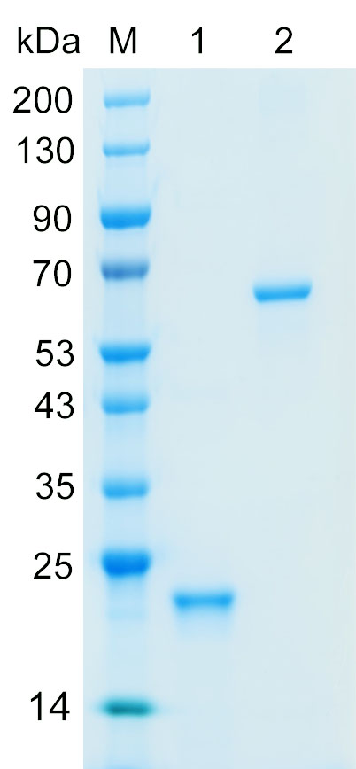 Recombinant A1AG2 protein (His tag) SDS-PAGE