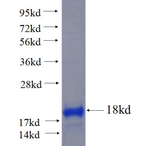 Recombinant human RPTN SDS-PAGE