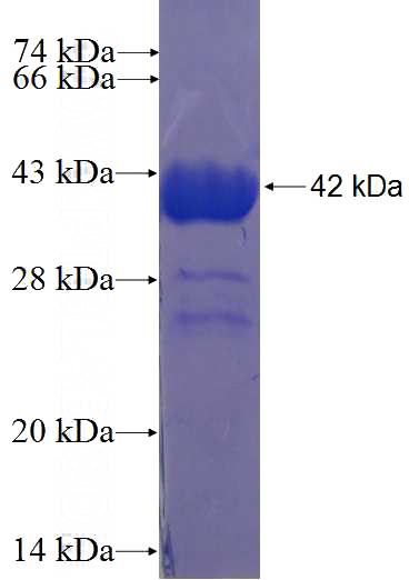 Recombinant Human C14orf119 SDS-PAGE