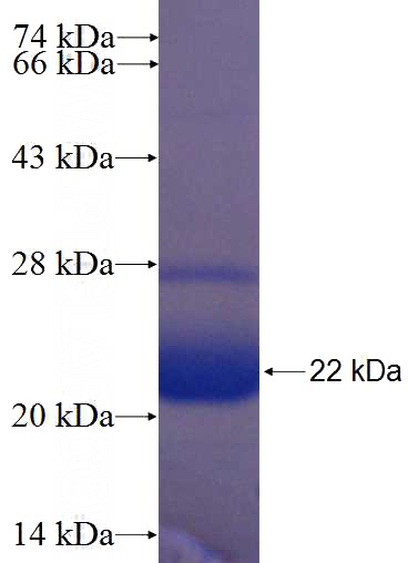 Recombinant Human GLE1 SDS-PAGE