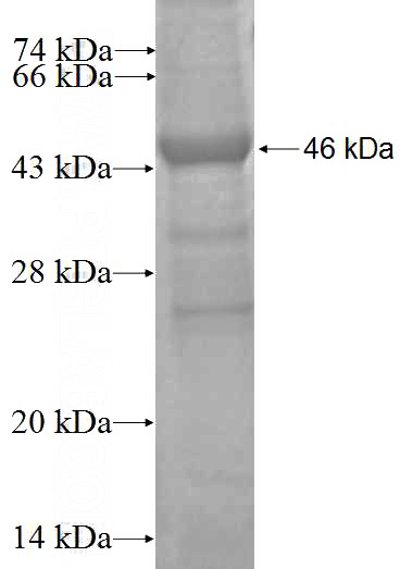 Recombinant Human MAD2L1 SDS-PAGE