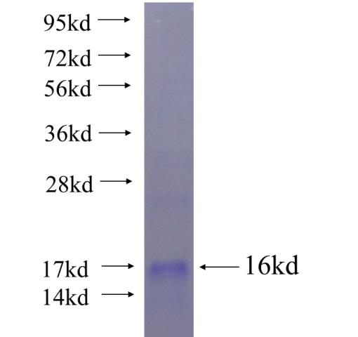 Recombinant human FAM70B SDS-PAGE