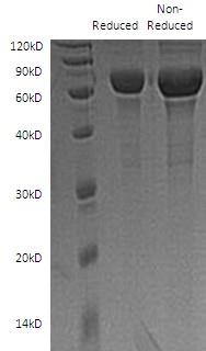 Human SCG3/UNQ2502/PRO5990 (His tag) recombinant protein