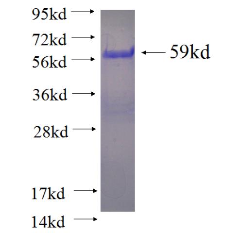 Recombinant human WDR74 SDS-PAGE