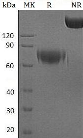 Human IFNAR2/IFNABR/IFNARB (Fc tag) recombinant protein