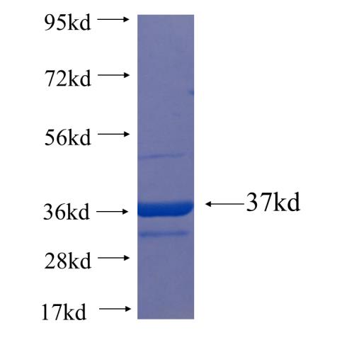 Recombinant Arabidopsis thaliana ATFD2 SDS-PAGE