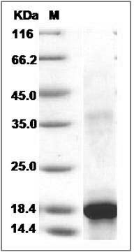Human KIT / c-KIT / CD117 Protein (aa 50-190, His Tag) SDS-PAGE