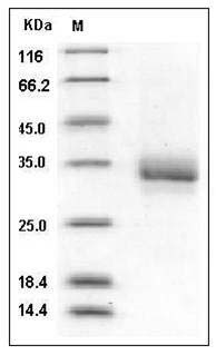 Human CD32b / FCGR2B Protein (His & AVI Tag) SDS-PAGE