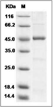 Human SPHK1 / Sphingosine Kinase 1 Protein SDS-PAGE