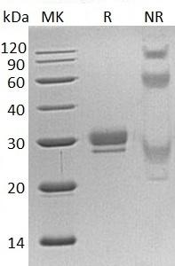 Human CTHRC1/UNQ762/PRO1550 (His tag) recombinant protein