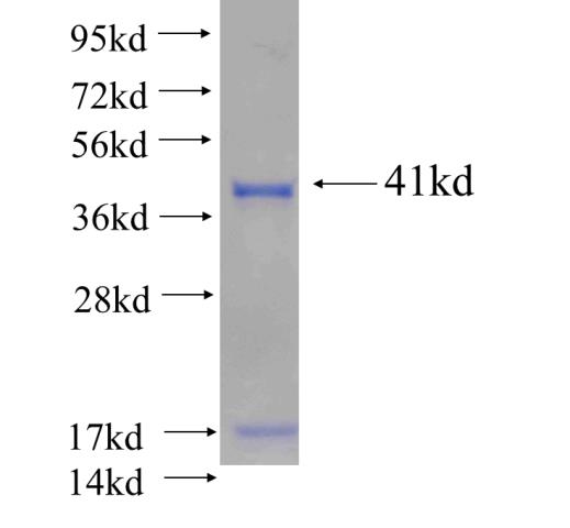 Recombinant human HNRNPH3 SDS-PAGE