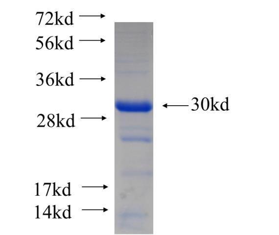 Recombinant human GTF3C6(Full length) SDS-PAGE