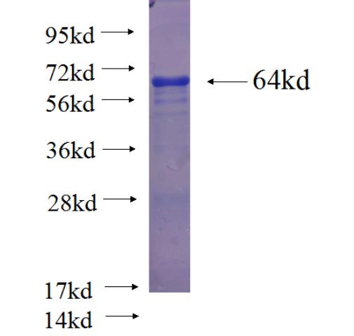 Recombinant human WDR48 SDS-PAGE