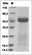 Rat IL-11RA1 / Il11RA1 Protein (His Tag)