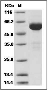 Influenza A H7N9 (A/Shanghai/1/2013) Hemagglutinin / HA Protein (His Tag) SDS-PAGE