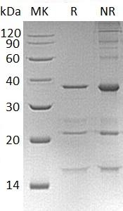 Human PITPNA/PITPN (His tag) recombinant protein