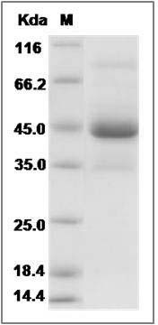 Cynomolgus ACVR1B / ALK-4 Protein (Fc Tag) SDS-PAGE