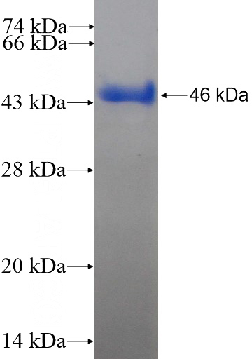 Recombinant Human ATP6V0D1 SDS-PAGE
