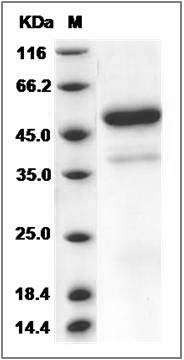 Rat VEGF-D / VEGFD / FIGF Protein (Fc Tag) SDS-PAGE