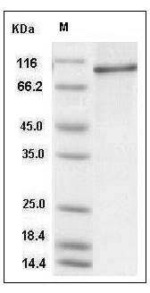 Human STAT6 Protein (His Tag) SDS-PAGE