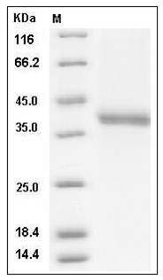 Cynomolgus CXCL12 / SDF-1 Protein (Fc Tag) SDS-PAGE
