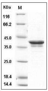 Human PDK / PDZ binding kinase / TOPK Protein (His Tag) SDS-PAGE