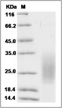 Human MMGT1 / EMC5 Protein (His Tag) SDS-PAGE