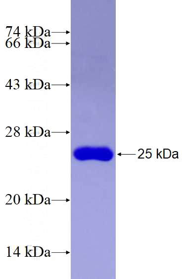 Recombinant Human RPL17 SDS-PAGE