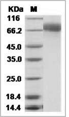 Influenza A H3N2 (A/Texas/50/2012) Hemagglutinin / HA Protein (His Tag)