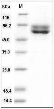 Human FUT10 / Fucosyltransferase 10 Protein (His Tag) SDS-PAGE