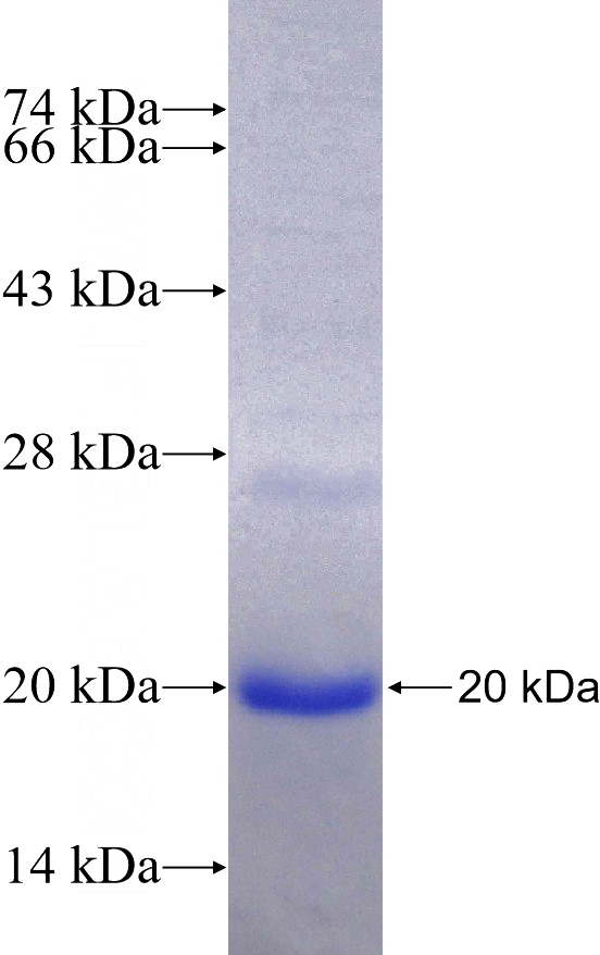 Recombinant Human ID1 SDS-PAGE