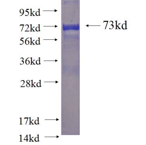 Recombinant Arabidopsis thaliana AGD2 SDS-PAGE