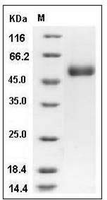 Human ACPL2 Protein (His Tag) SDS-PAGE