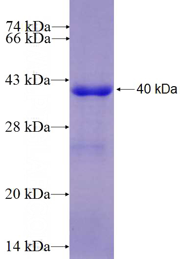 Recombinant Human PPP3CB SDS-PAGE