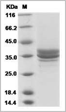 Human DC-SIGNR / CD299 Protein ()