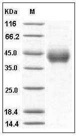 Human TNFR2 / CD120b / TNFRSF1B Protein (His Tag) SDS-PAGE