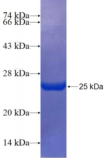 Recombinant Human SP3 SDS-PAGE