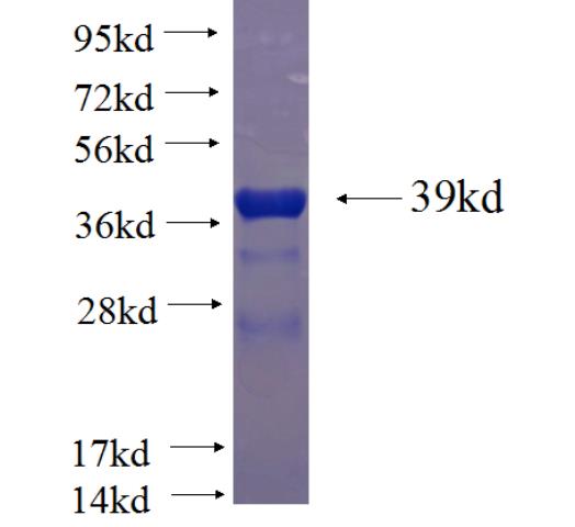 Recombinant human GAGE7 SDS-PAGE