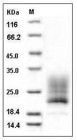 Mouse REG4 / GISP / RELP Protein (His Tag) SDS-PAGE