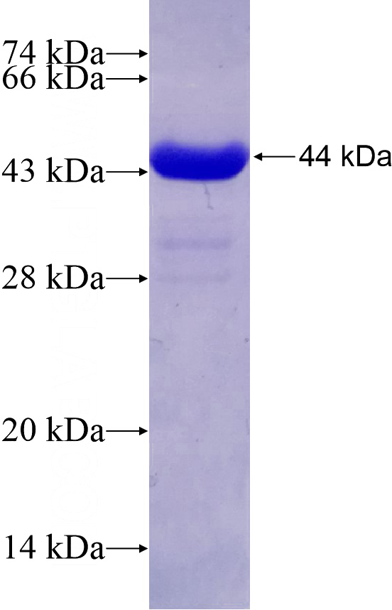 Recombinant Human GLDC SDS-PAGE