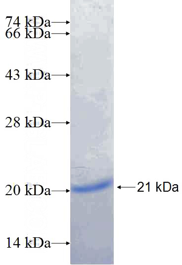 Recombinant Human KCTD6 SDS-PAGE