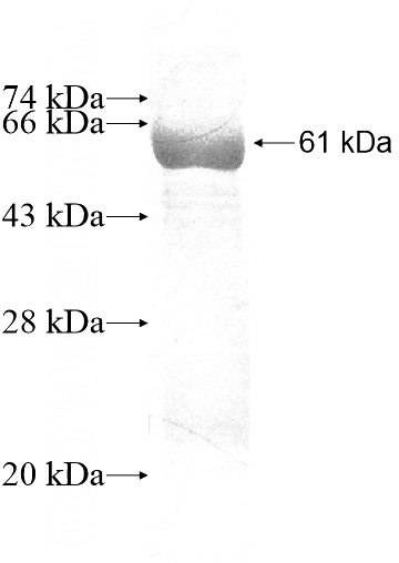 Recombinant Human ACHE SDS-PAGE