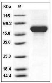 Human CD131 / CSF2RB / IL3RB / IL5RB Protein (His Tag) SDS-PAGE