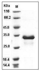 Human SULT1E1 / ST1E1 Protein (His Tag) SDS-PAGE