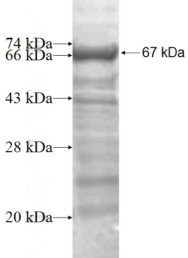 Recombinant Human C1S SDS-PAGE