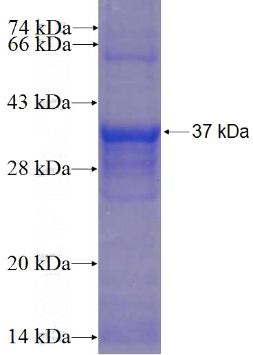 Recombinant Human C17orf58 SDS-PAGE