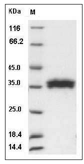 Human RNASET2 Protein (His Tag) SDS-PAGE
