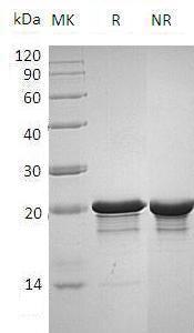 Human/Mouse FGF8/AIGF recombinant protein