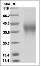 Cynomolgus B7-H5 / GI24 / VISTA Protein (His Tag)
